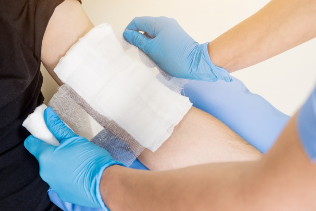 Enfermera vendando la herida de la mano del paciente con lesion por quemadura