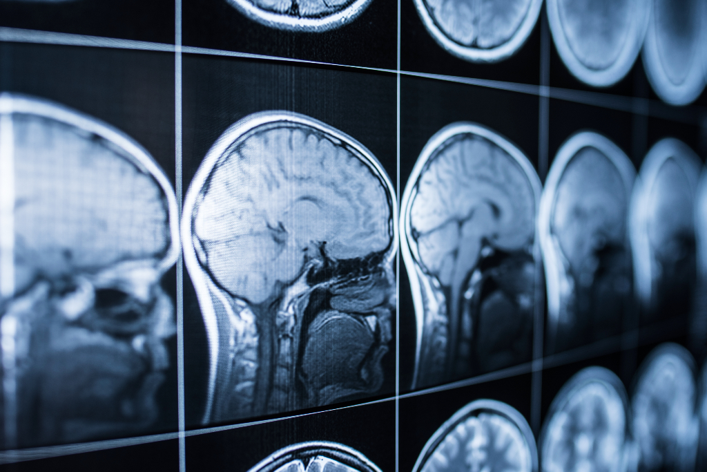 Radiografia de la cabeza y el cerebro de una persona